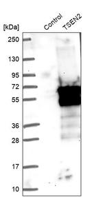 TSEN2 Antibody in Western Blot (WB)