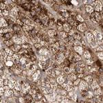 NUP43 Antibody in Immunohistochemistry (IHC)