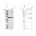 NUP43 Antibody in Western Blot (WB)