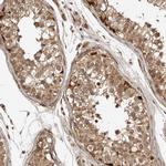 ADPRHL2 Antibody in Immunohistochemistry (IHC)