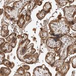 ADPRHL2 Antibody in Immunohistochemistry (IHC)