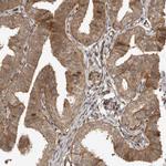 ADPRHL2 Antibody in Immunohistochemistry (IHC)