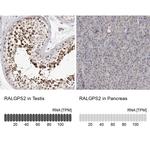 RALGPS2 Antibody in Immunohistochemistry (IHC)