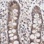 RALGPS2 Antibody in Immunohistochemistry (IHC)