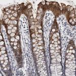 IFI44 Antibody in Immunohistochemistry (IHC)