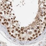 ZNF830 Antibody in Immunohistochemistry (IHC)