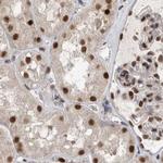 ZNF830 Antibody in Immunohistochemistry (IHC)