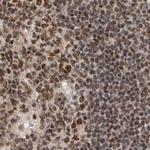 ZNF830 Antibody in Immunohistochemistry (IHC)