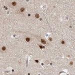 ZNF830 Antibody in Immunohistochemistry (IHC)