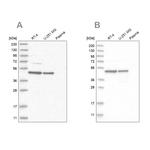 ZNF830 Antibody in Western Blot (WB)