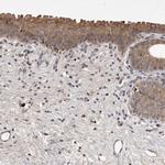 UBE3D Antibody in Immunohistochemistry (IHC)