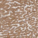 Lass2 Antibody in Immunohistochemistry (IHC)