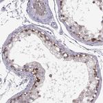 C17orf104 Antibody in Immunohistochemistry (IHC)