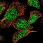 TSEN2 Antibody in Immunocytochemistry (ICC/IF)