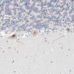 TSEN2 Antibody in Immunohistochemistry (IHC)