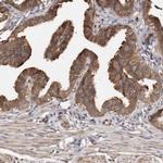 ADCK4 Antibody in Immunohistochemistry (IHC)