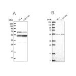 ADCK4 Antibody in Western Blot (WB)