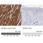 Calsequestrin 2 Antibody in Immunohistochemistry (IHC)