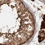 CAMSAP2 Antibody in Immunohistochemistry (IHC)