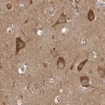 CAMSAP2 Antibody in Immunohistochemistry (IHC)