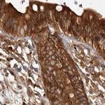 CAMSAP2 Antibody in Immunohistochemistry (IHC)