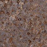 CAMSAP2 Antibody in Immunohistochemistry (IHC)