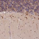 S100PBP Antibody in Immunohistochemistry (IHC)