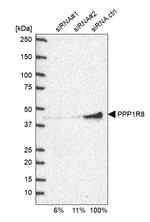 PPP1R8 Antibody