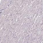 CHCHD2 Antibody in Immunohistochemistry (IHC)