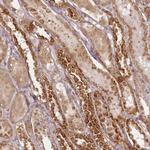 CHCHD2 Antibody in Immunohistochemistry (IHC)