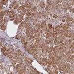 CHCHD2 Antibody in Immunohistochemistry (IHC)