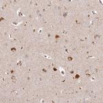 CHCHD2 Antibody in Immunohistochemistry (IHC)