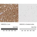 HMGCS2 Antibody in Immunohistochemistry (IHC)