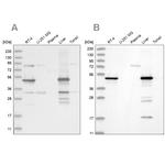 HMGCS2 Antibody in Western Blot (WB)