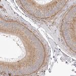 VPS45 Antibody in Immunohistochemistry (IHC)