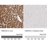 HMGCS2 Antibody in Immunohistochemistry (IHC)