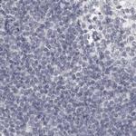 HMGCS2 Antibody in Immunohistochemistry (IHC)