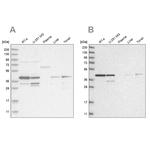 PPP1R8 Antibody in Western Blot (WB)