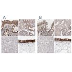 UFC1 Antibody in Immunohistochemistry (IHC)