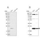 UFC1 Antibody in Western Blot (WB)