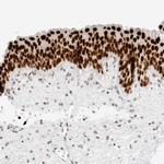 RCC1 Antibody in Immunohistochemistry (IHC)