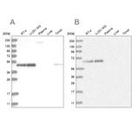 RCC1 Antibody in Western Blot (WB)