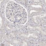 S100A14 Antibody in Immunohistochemistry (IHC)