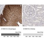 S100A14 Antibody