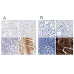 MYBPC1 Antibody in Immunohistochemistry (IHC)