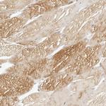 MYBPC1 Antibody in Immunohistochemistry (IHC)