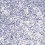 MYBPC1 Antibody in Immunohistochemistry (IHC)