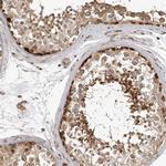 RABIF Antibody in Immunohistochemistry (IHC)