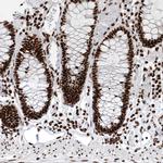 BCLAF1 Antibody in Immunohistochemistry (IHC)