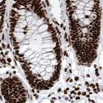 BCLAF1 Antibody in Immunohistochemistry (IHC)